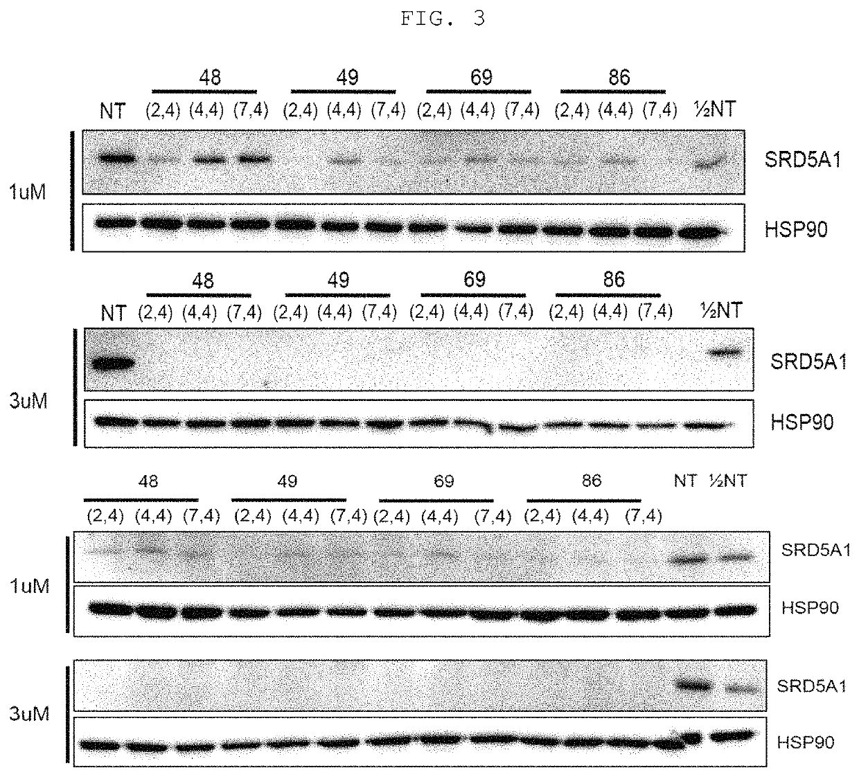 Asymmetric siRNA for inhibiting expression of male pattern hair loss target gene