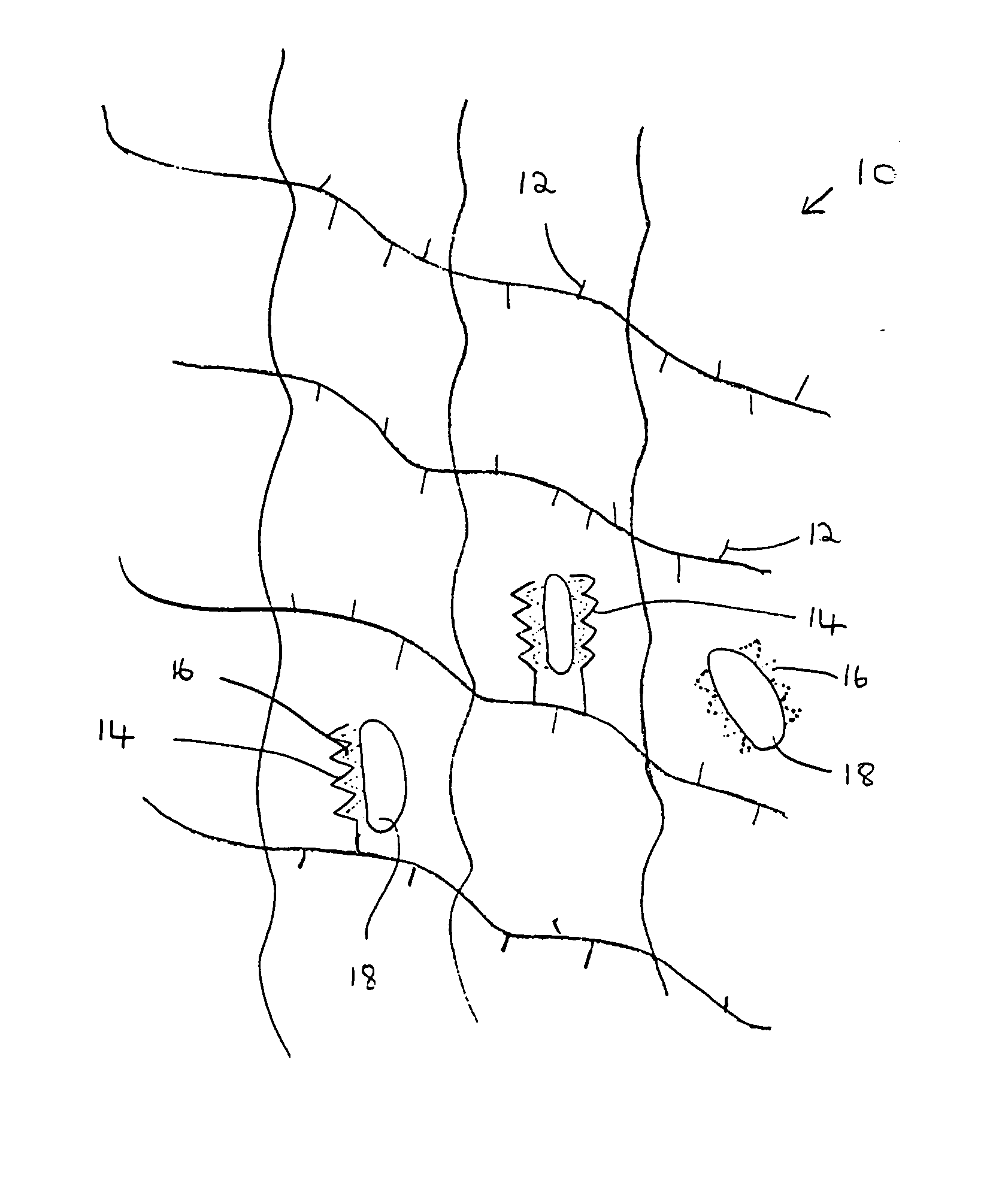 Composition and method for bone regeneration