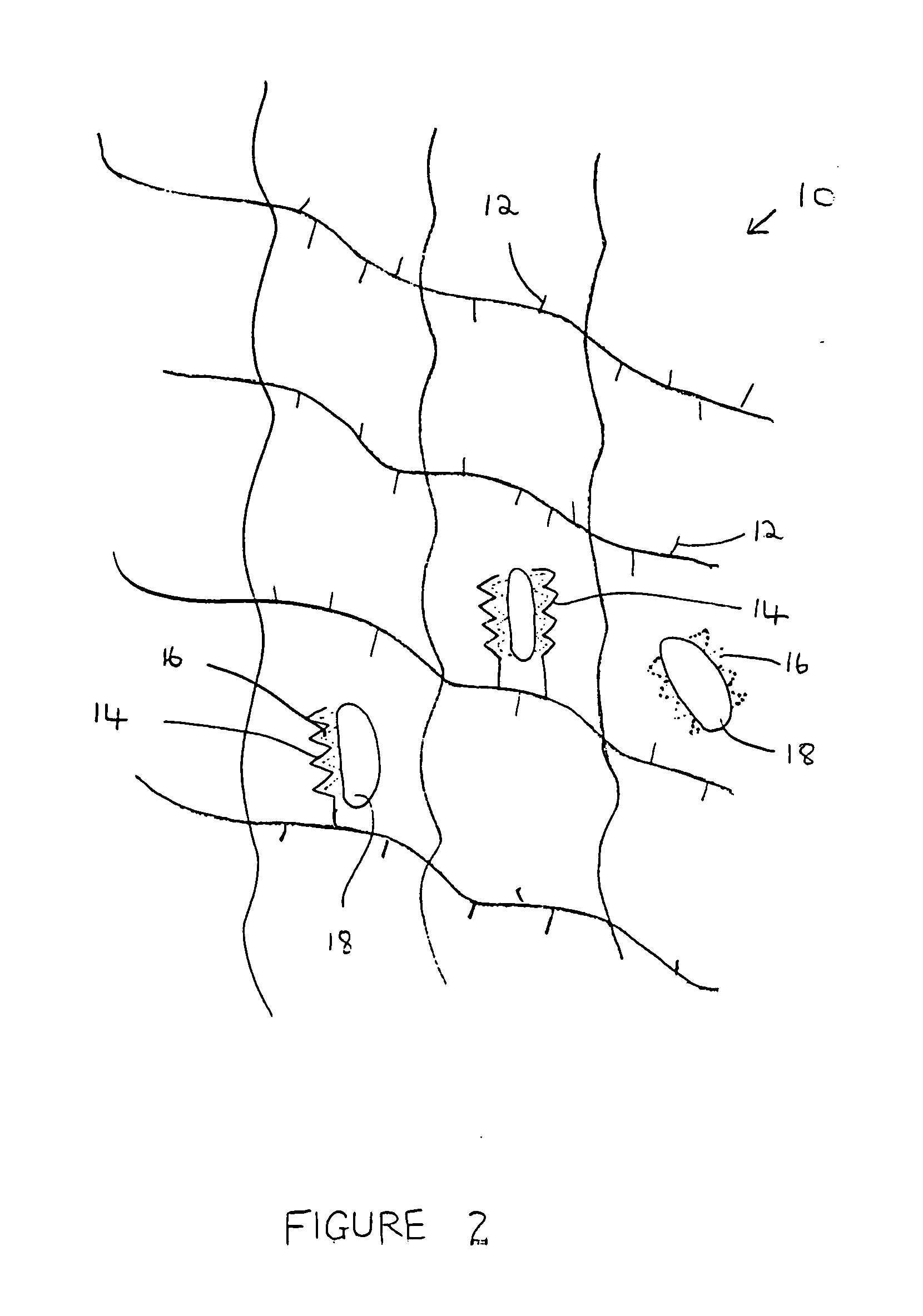 Composition and method for bone regeneration