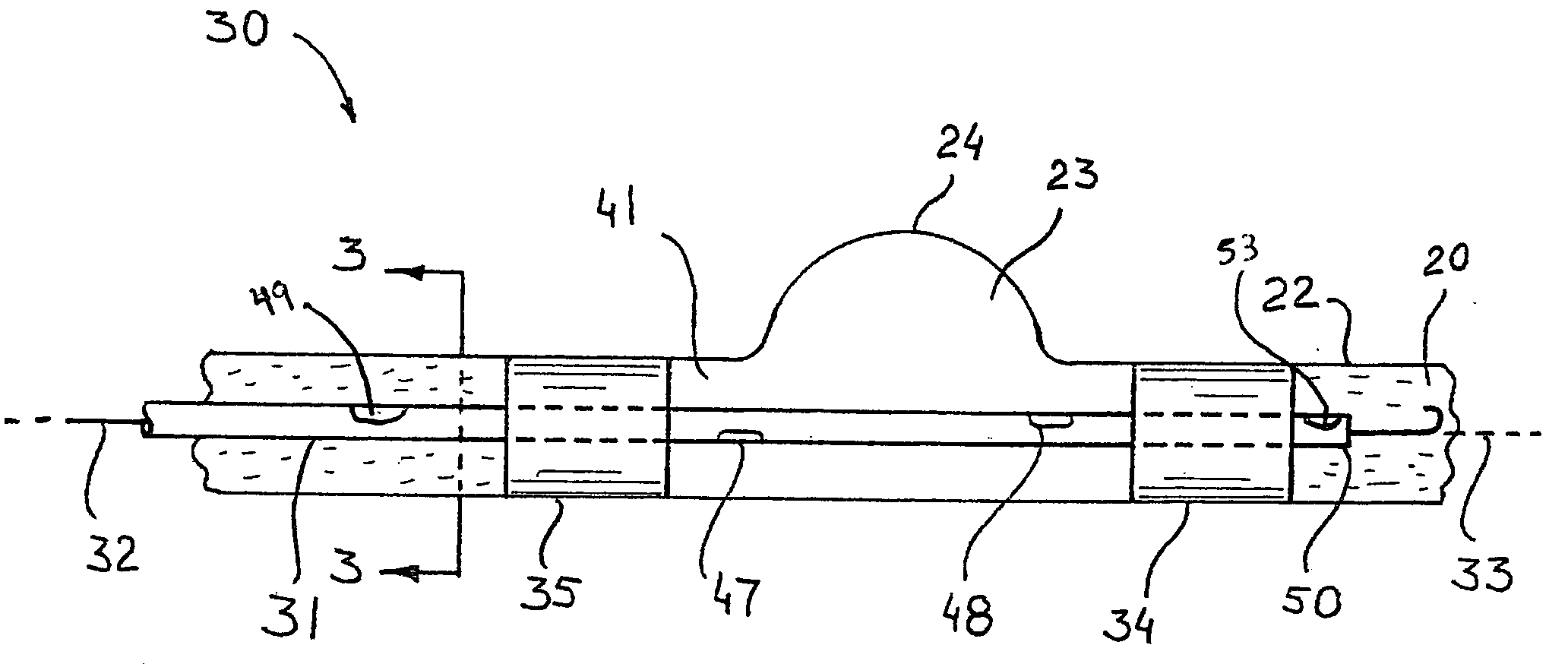 Method and apparatus for treating aneurysms