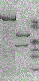 11-type recombinant human papilloma virus virus-like particle and preparation method thereof