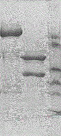 11-type recombinant human papilloma virus virus-like particle and preparation method thereof