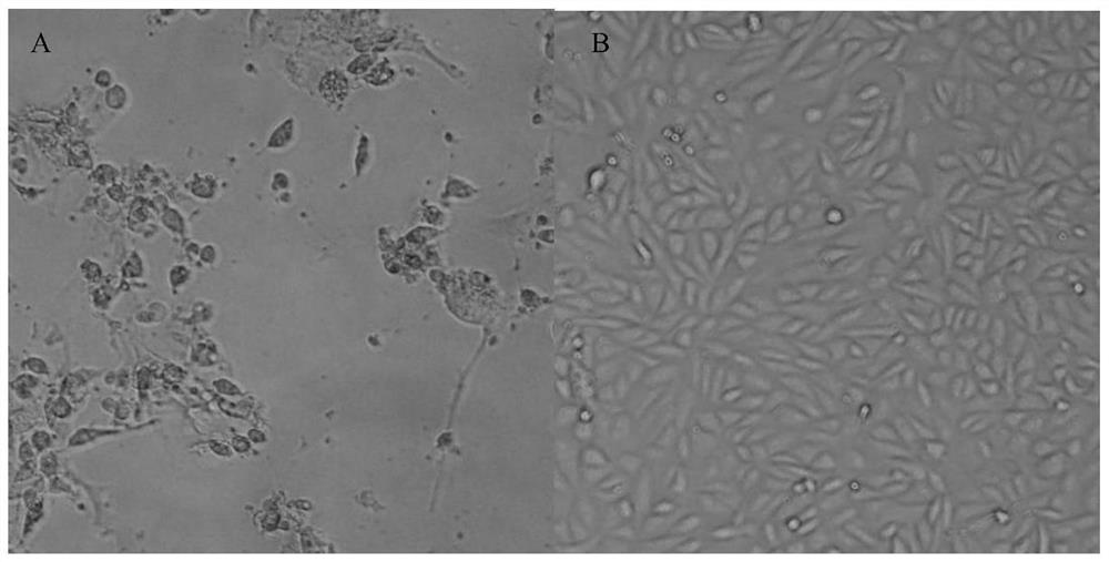 Real-time PCR detection method for human group H rotavirus