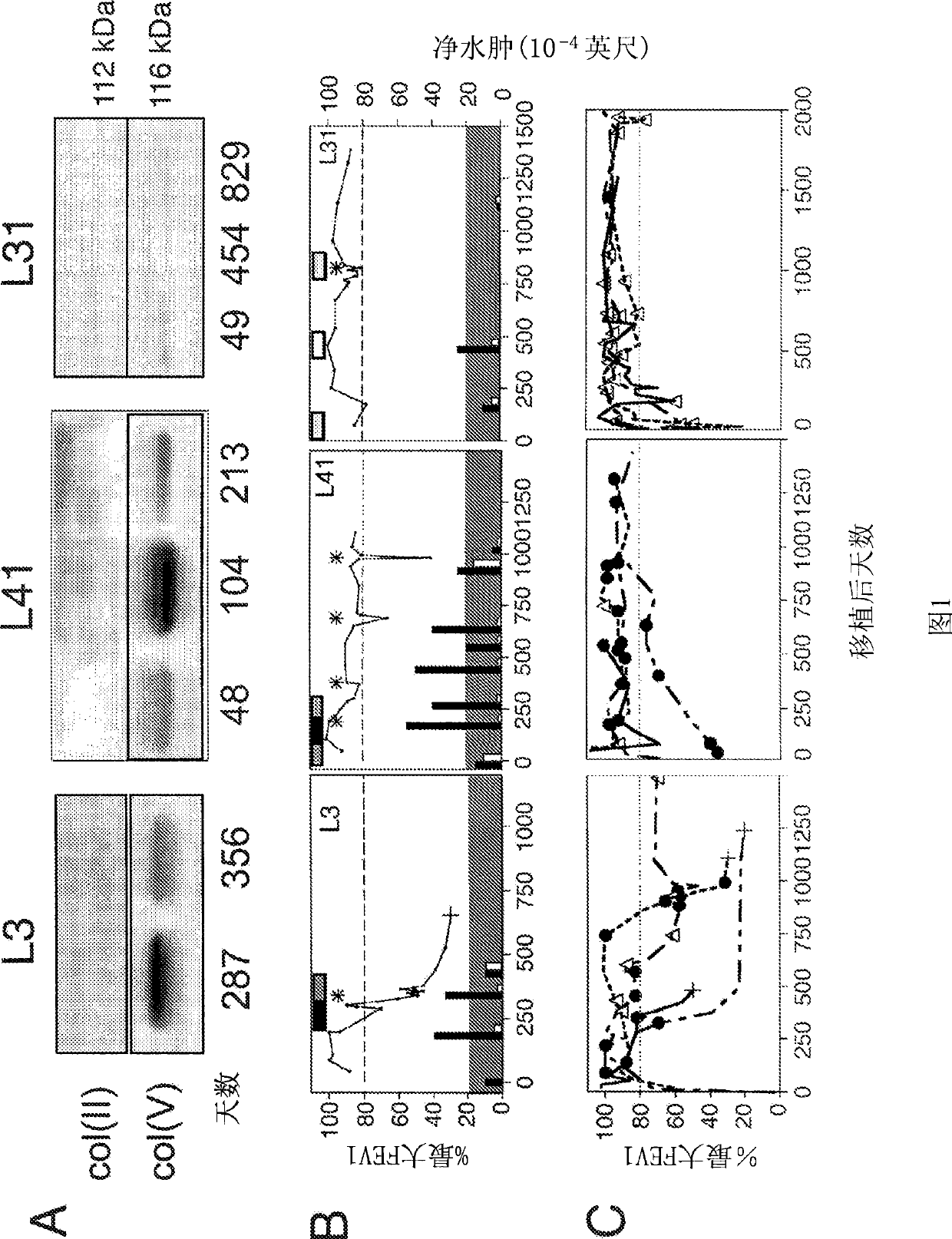 Molecules for the treatment of lung disease involving an immune reaction to connective tissue found in the lung