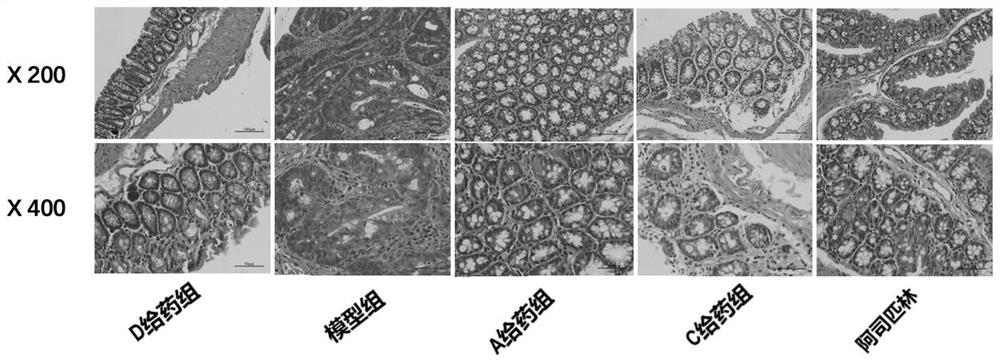 Traditional Chinese medicine composition for preventing and treating colorectal adenoma, and preparation method and application thereof