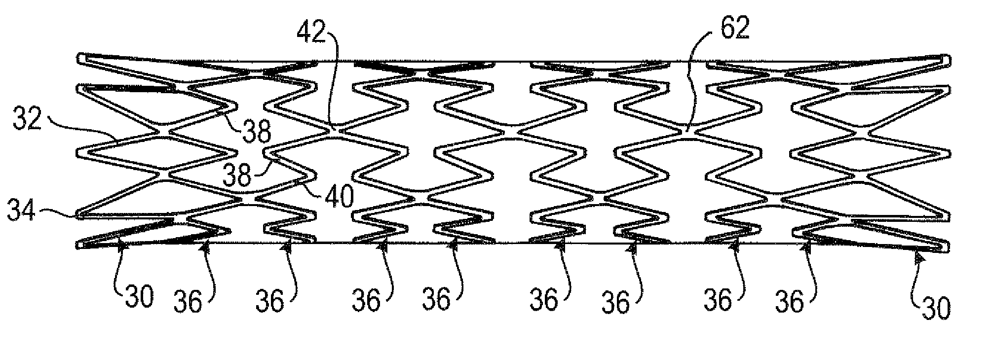 Bend-capable stent prosthesis