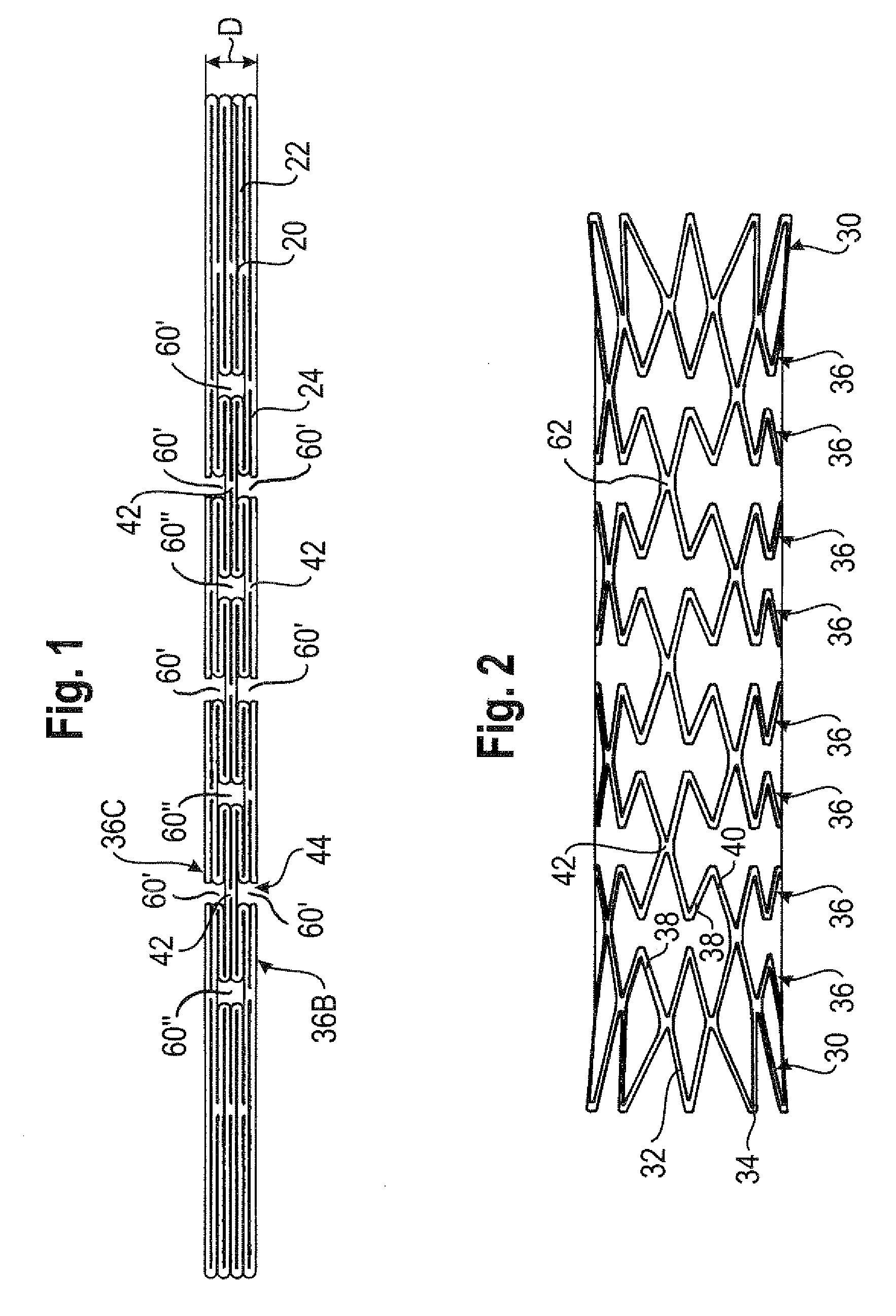 Bend-capable stent prosthesis