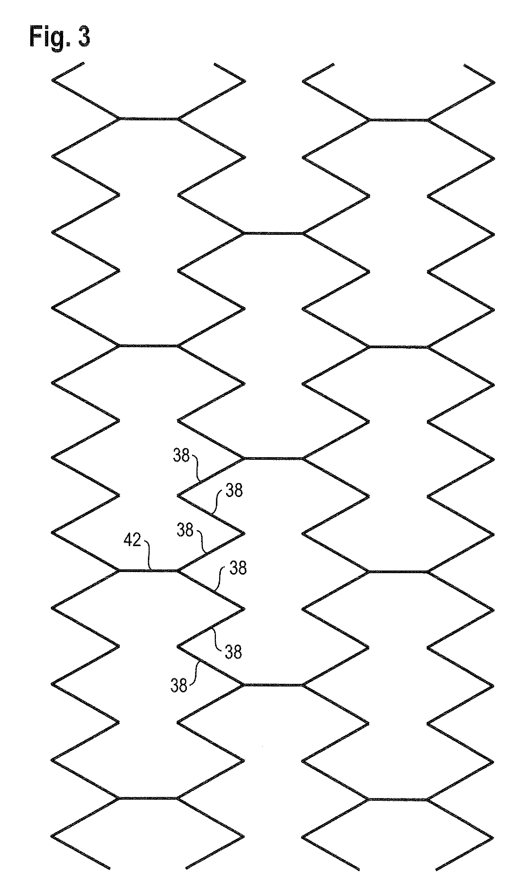 Bend-capable stent prosthesis