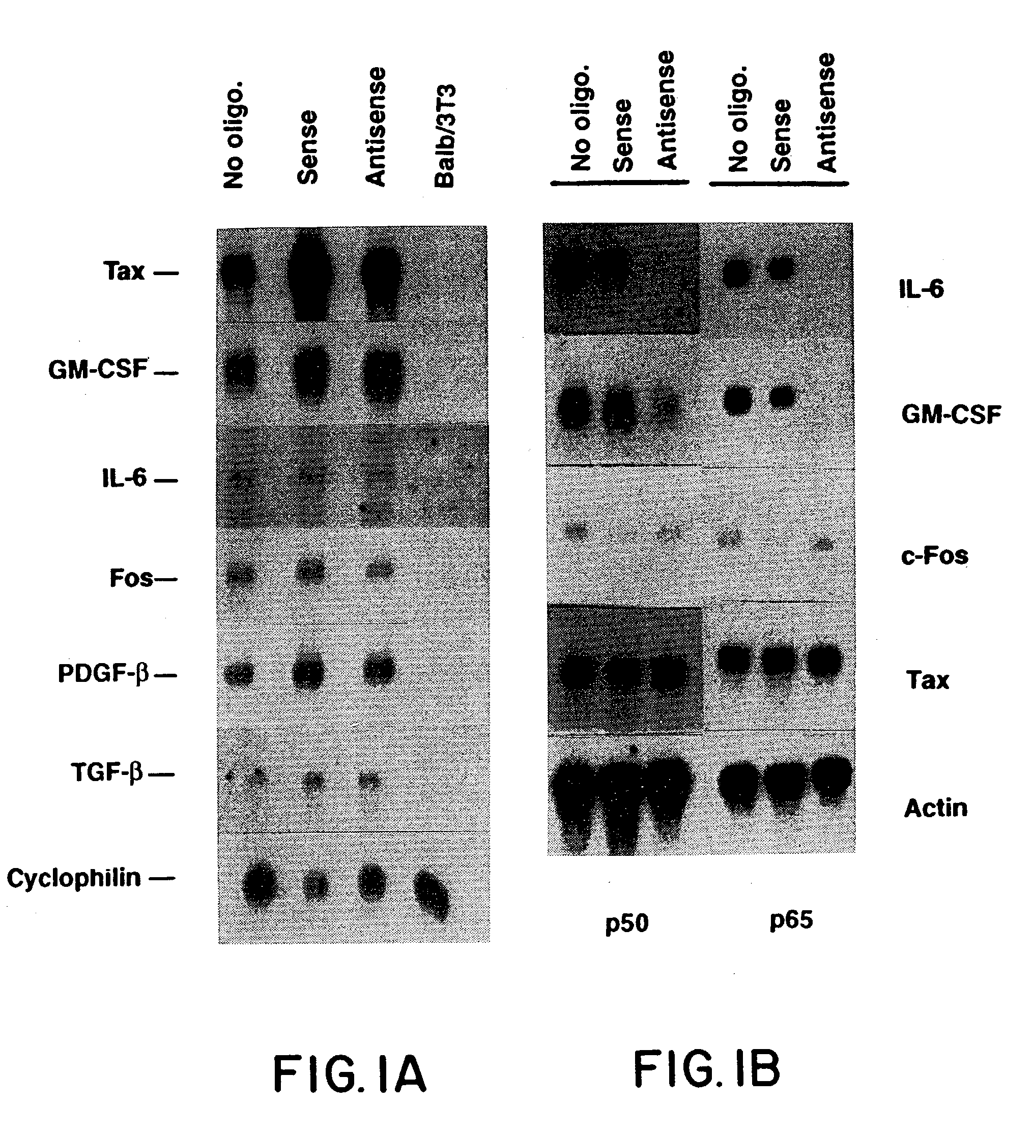 Suppression of nuclear factor-kappaB dependent processes using oligonucleotides