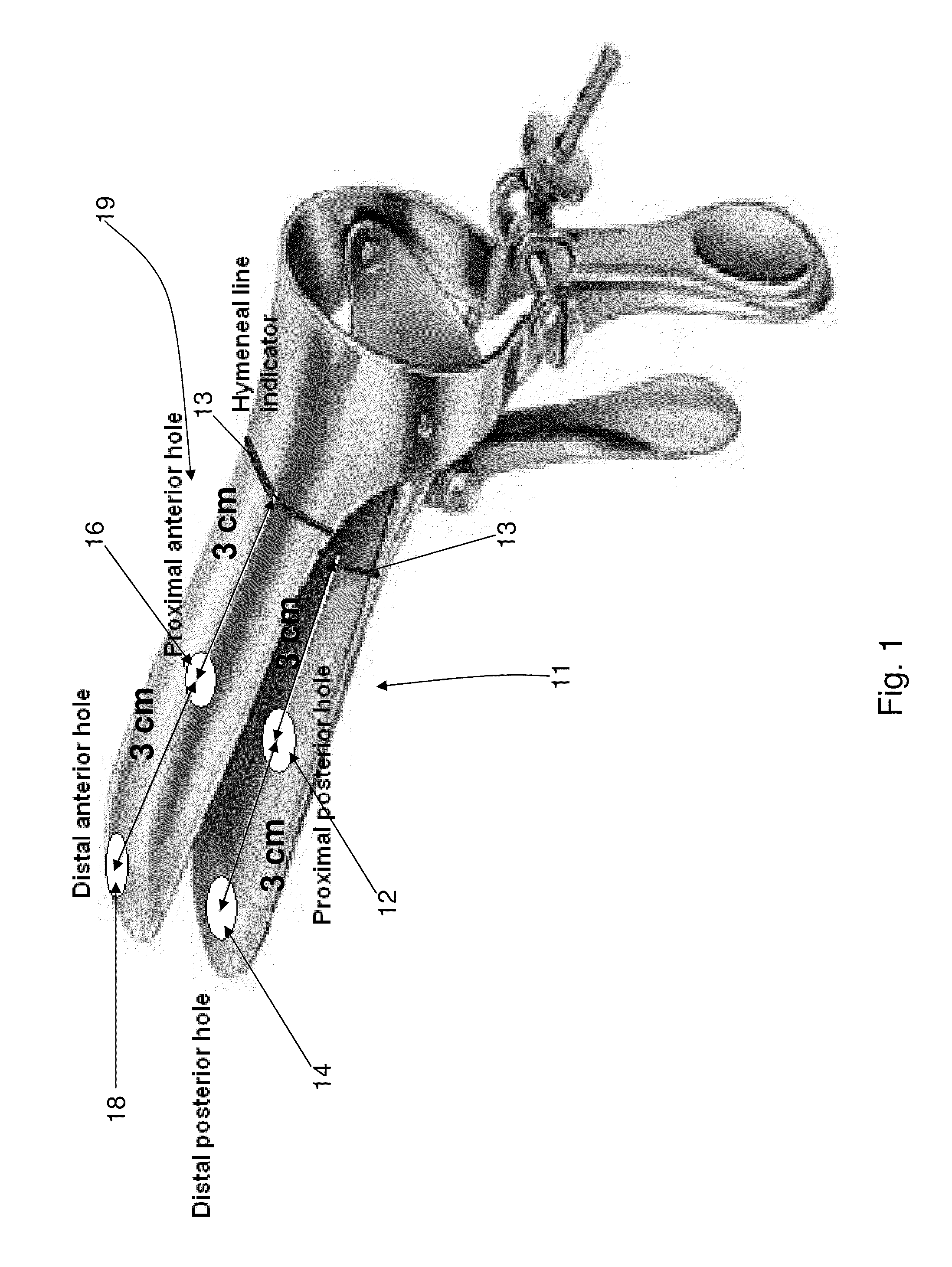 Electronic pelvic organ prolapse quantification system