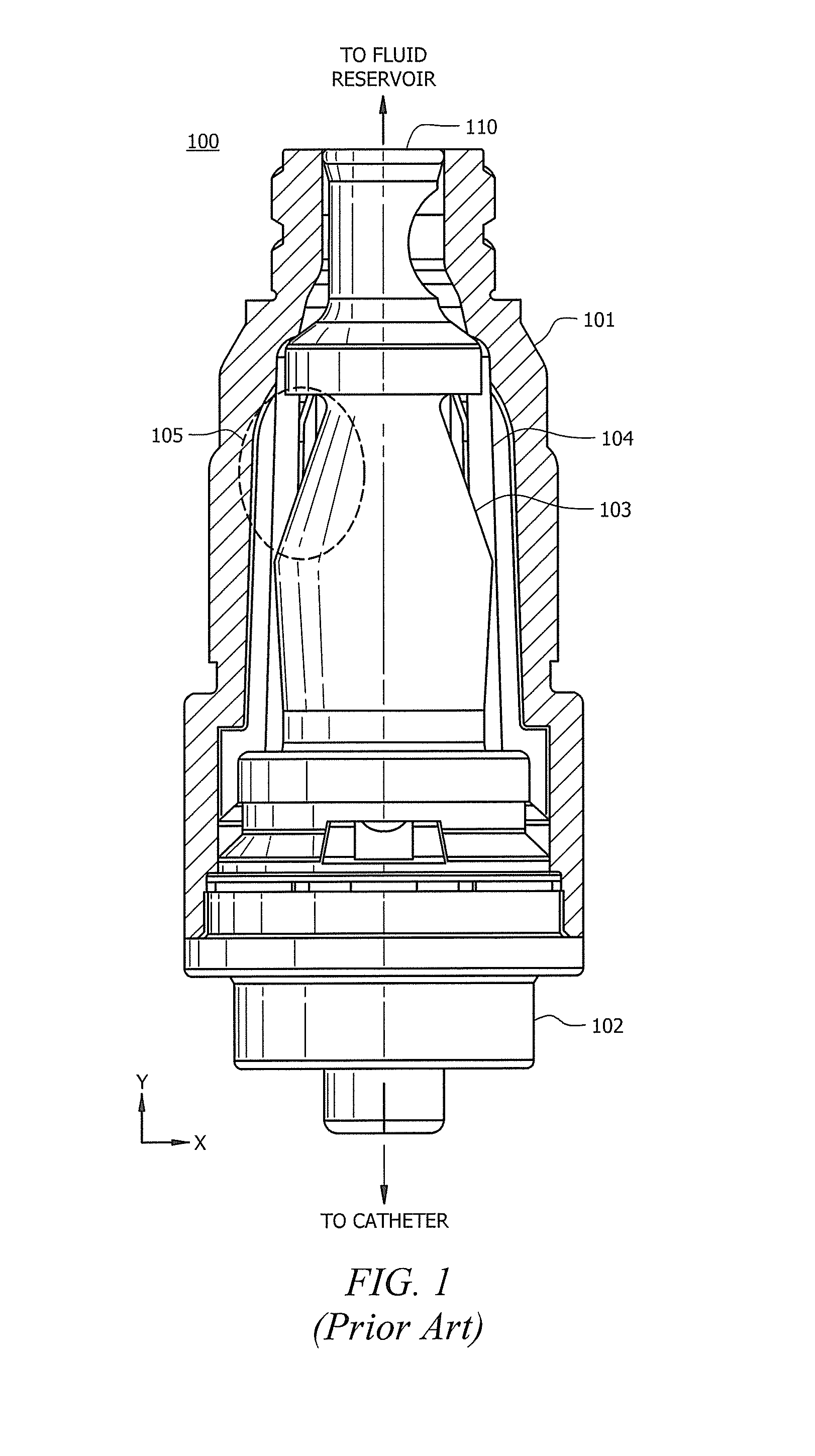 Collapsible Valve