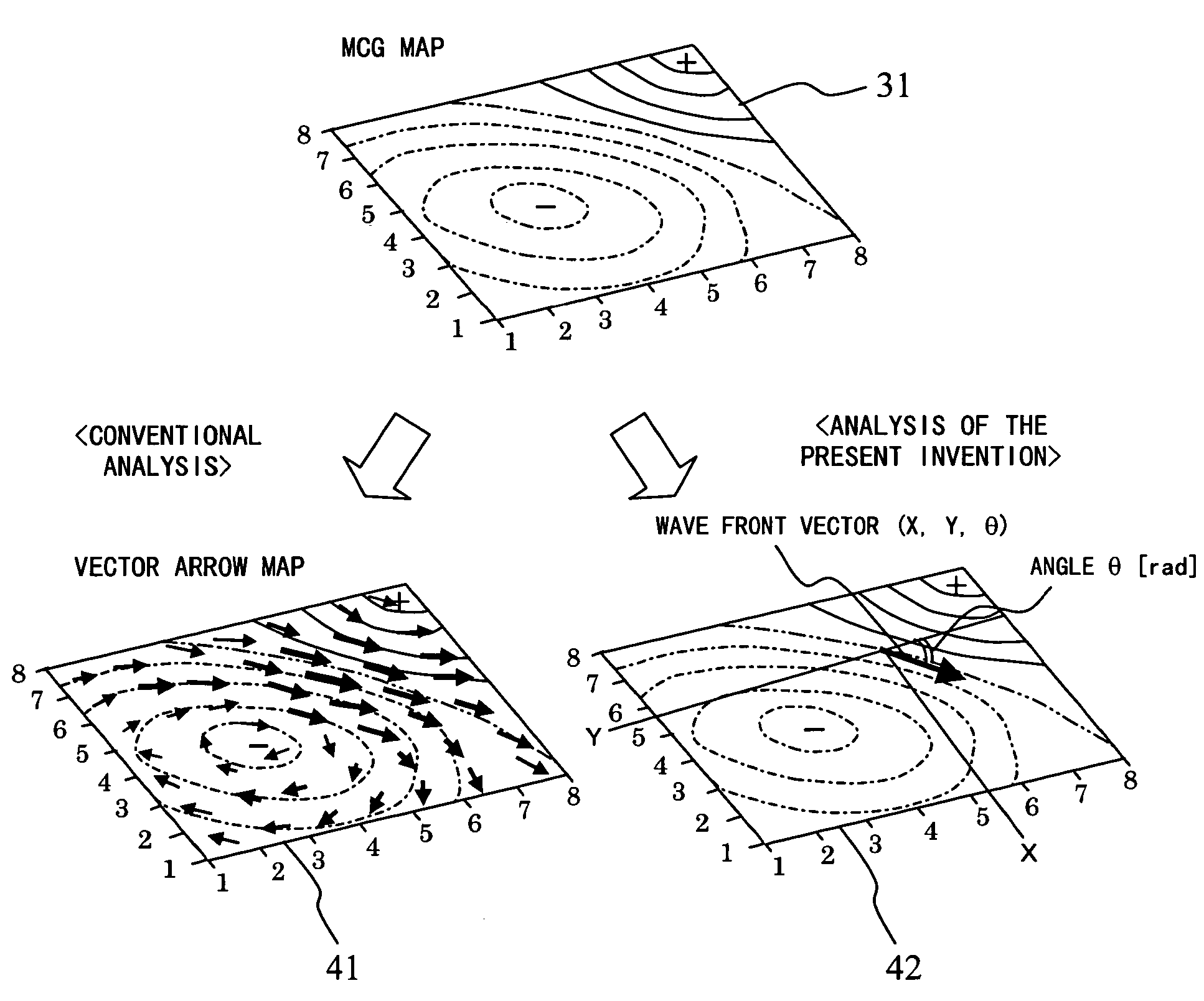 Magnetocardiograph