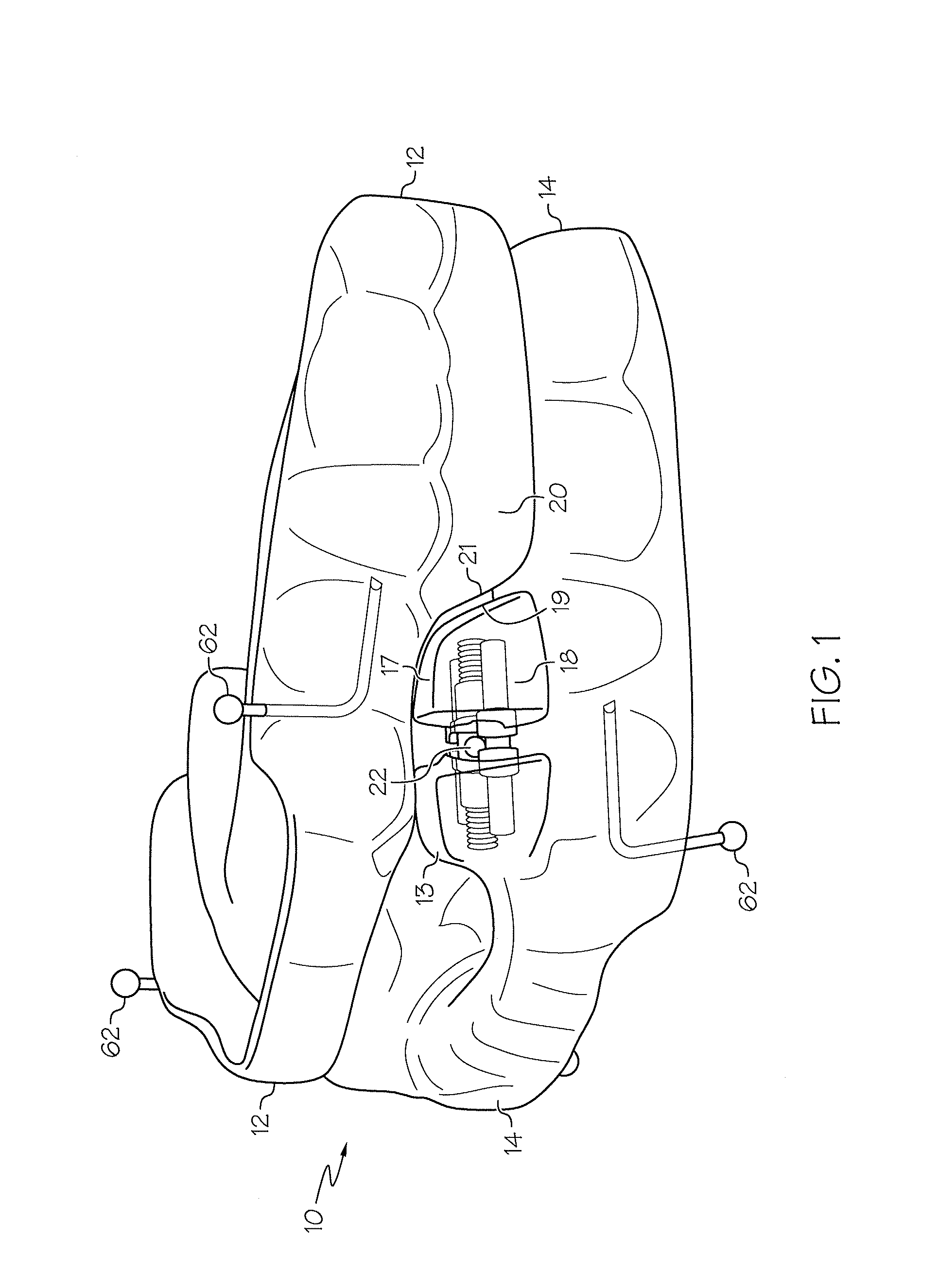 Intraoral apparatus for managing snoring and obstructive sleep apnea