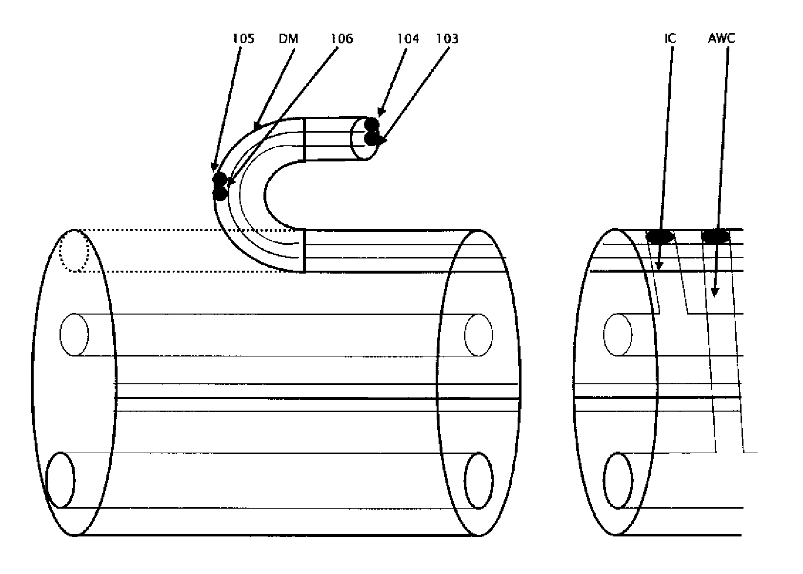 Next generation colonoscope