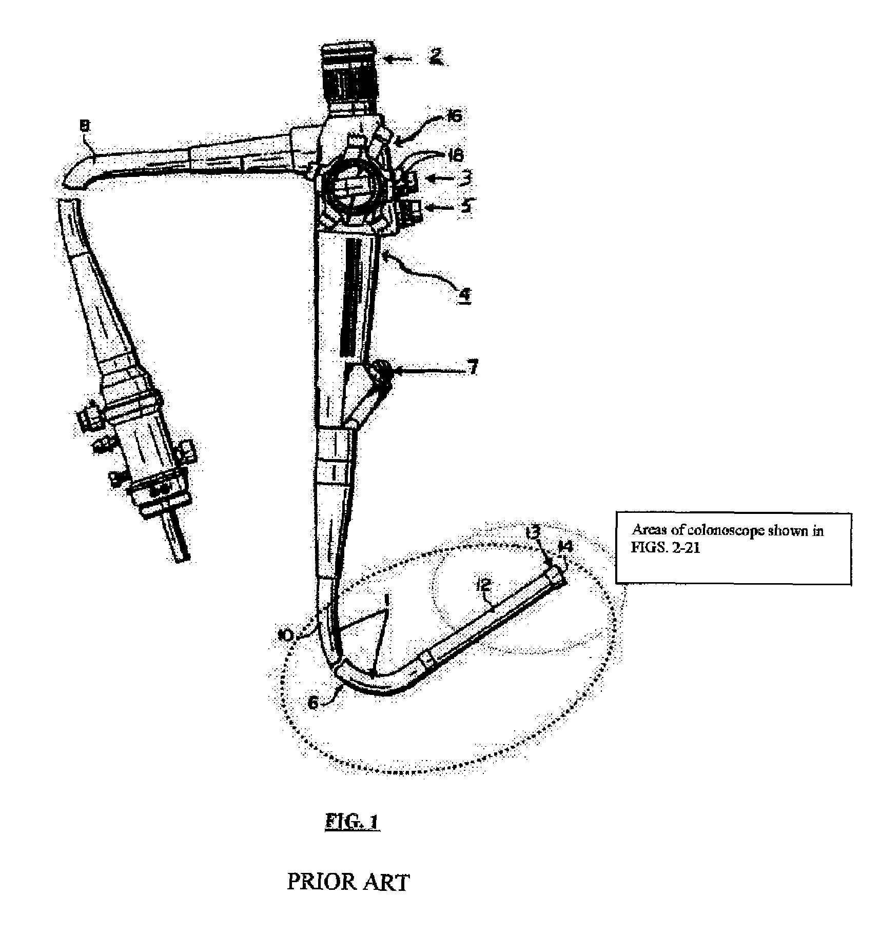 Next generation colonoscope