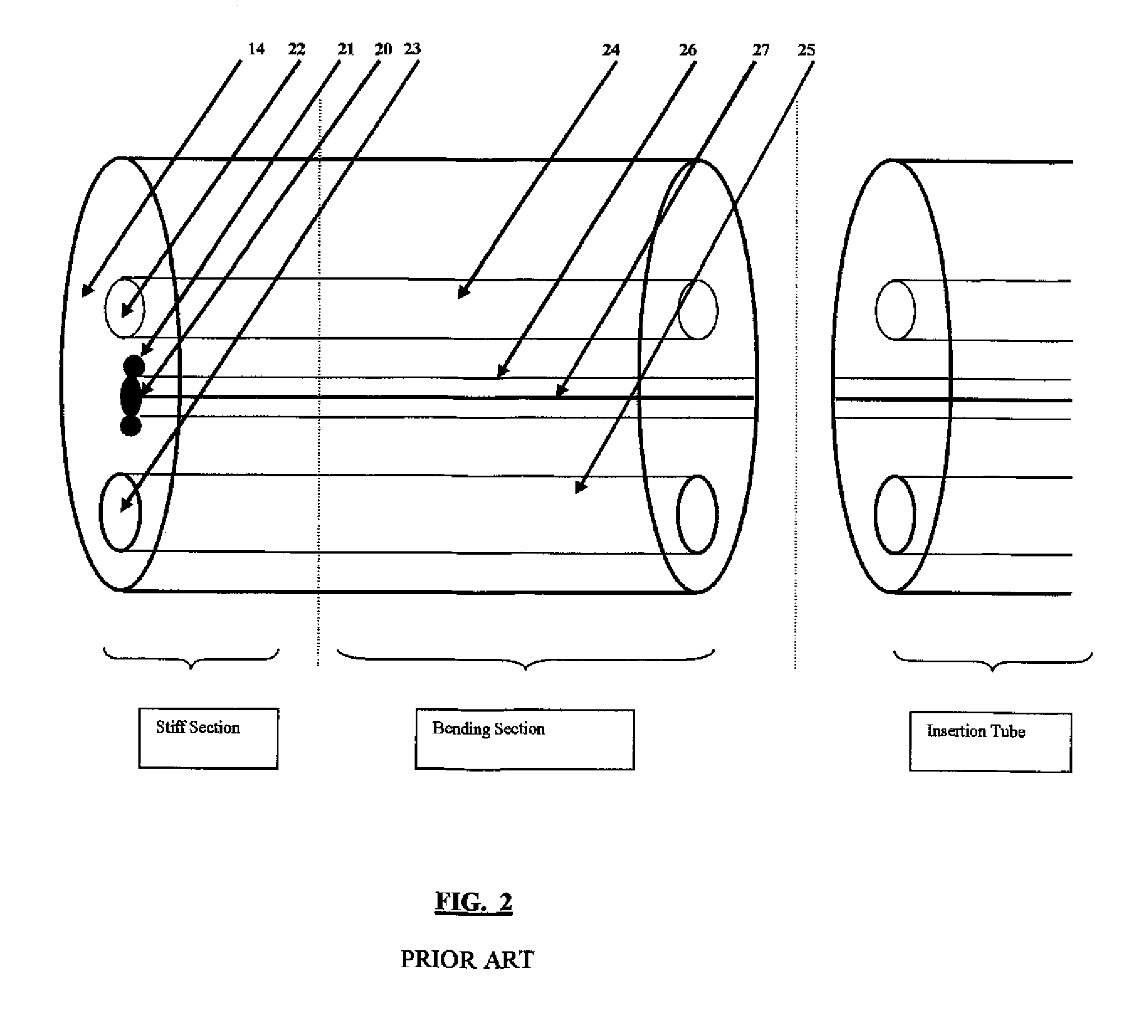 Next generation colonoscope