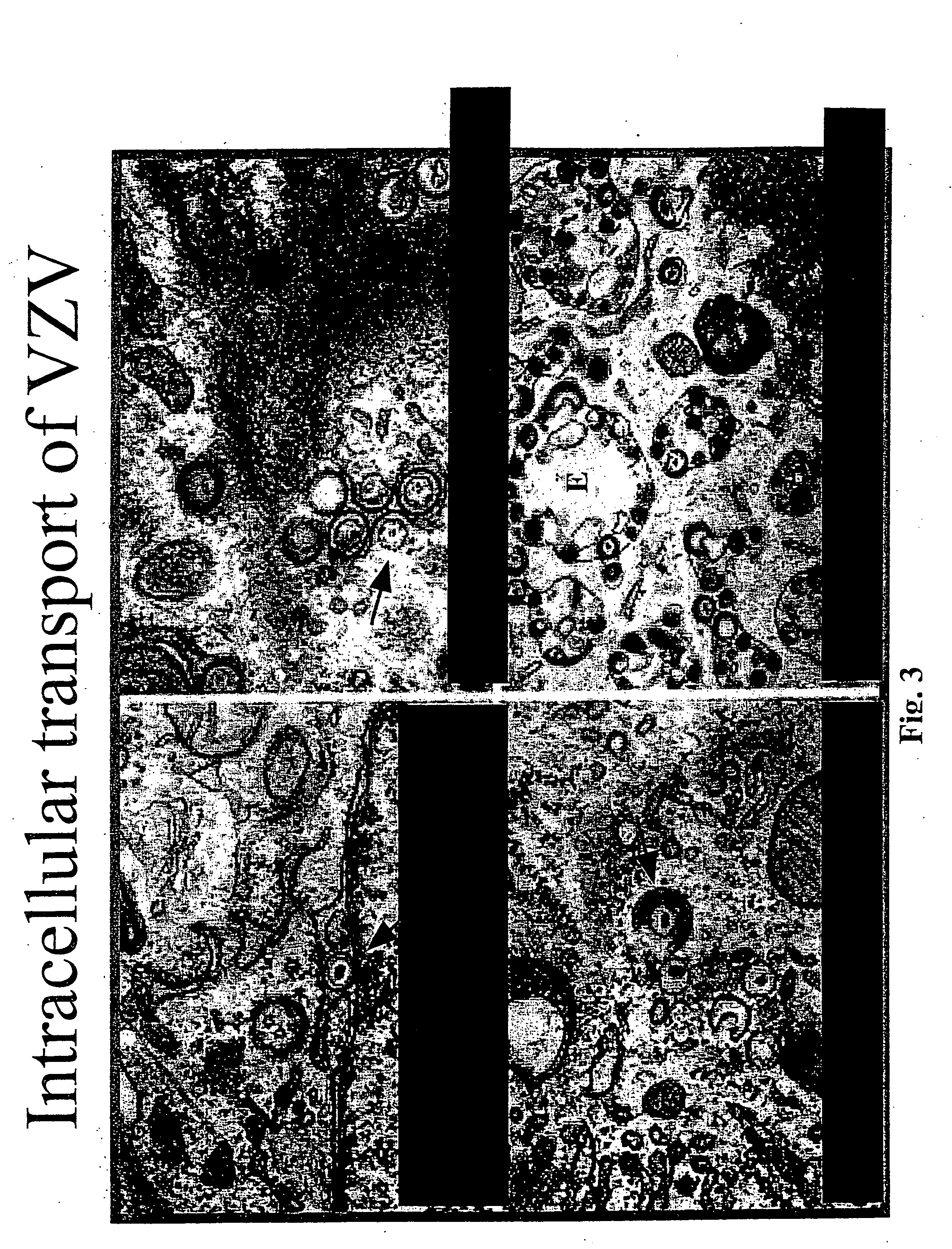 Genetically engineered cell lines and systems for propagating Varicella zoster virus and methods of use thereof