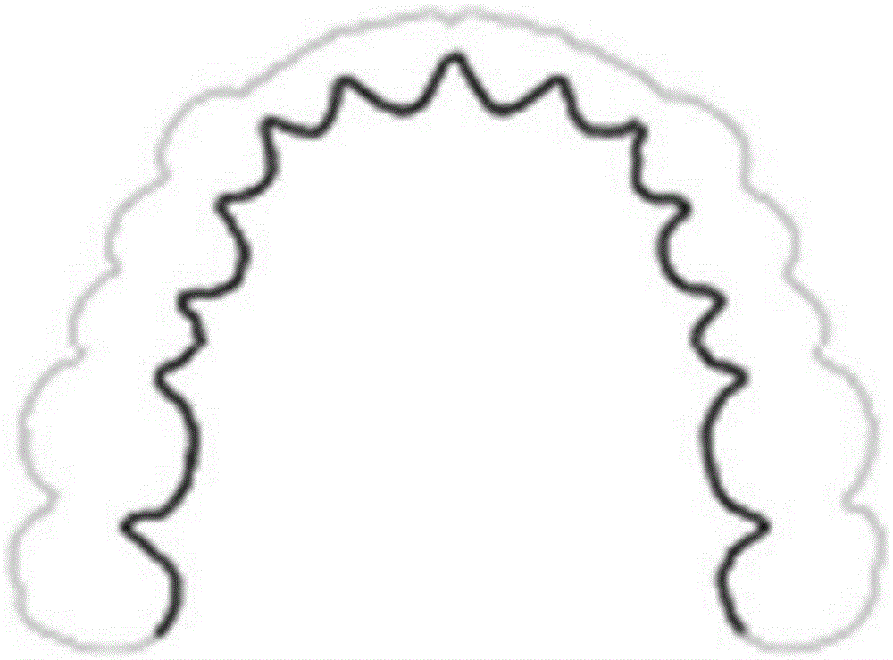 Gingival margin curve design method for personalized implant tooth