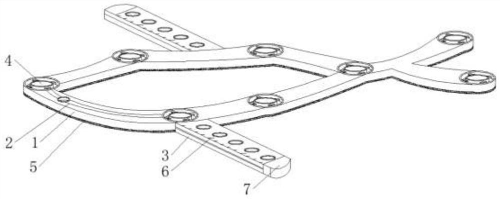 Fixation plate for calcaneal fracture