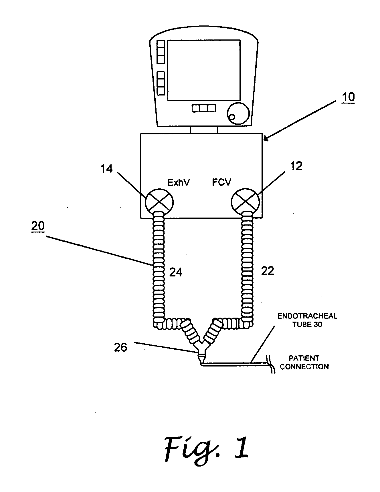 Patient circuit disconnect system for a ventilator and method of detecting patient circuit disconnect