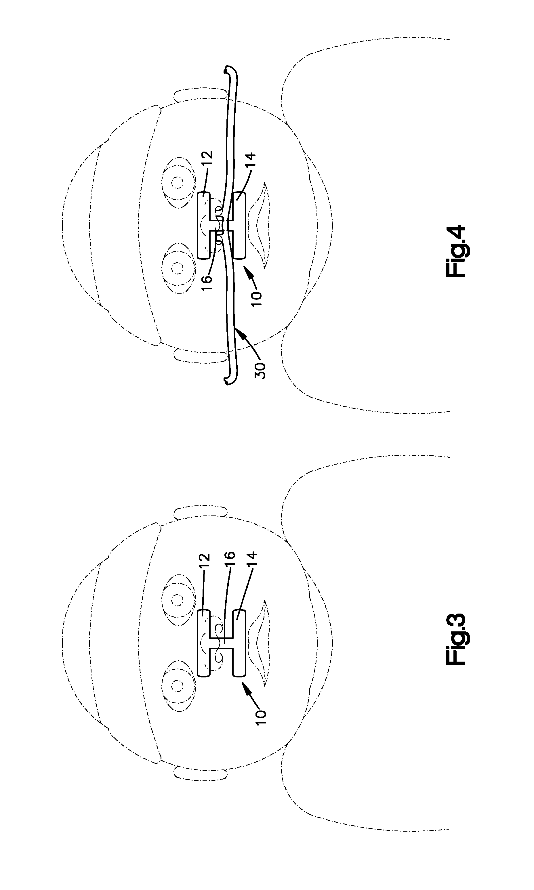 Infant Nasal Septum Protective Device