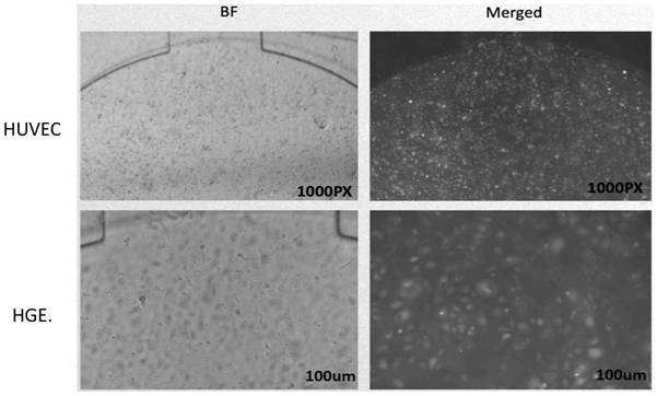 Periodontal soft tissue bionic chip constructed on basis of microfluidic technology and application of periodontal soft tissue bionic chip