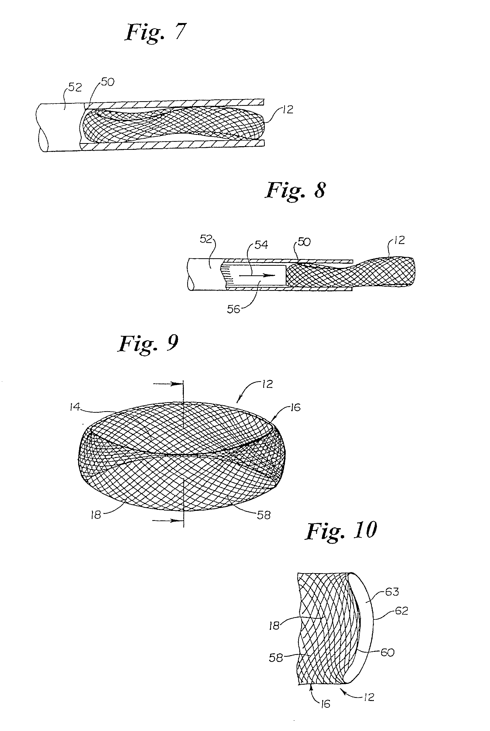 Annulus-reinforcing band