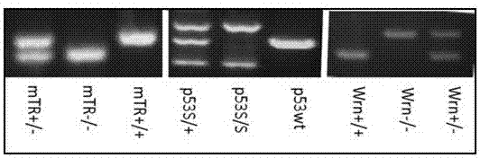 Application of P53 gene mutation and telomere dysfunction