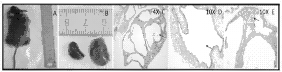 Application of P53 gene mutation and telomere dysfunction