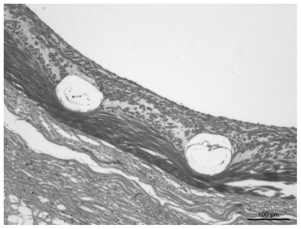 Implantable drug-loaded device