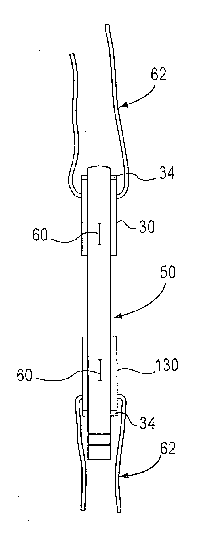 Bone-tendon-bone assembly with cancellous allograft bone block having cortical end portion