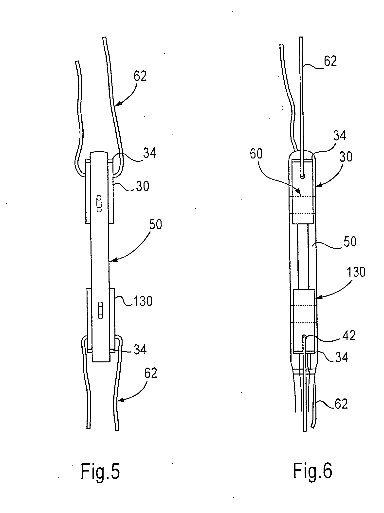 Bone-tendon-bone assembly with cancellous allograft bone block having cortical end portion