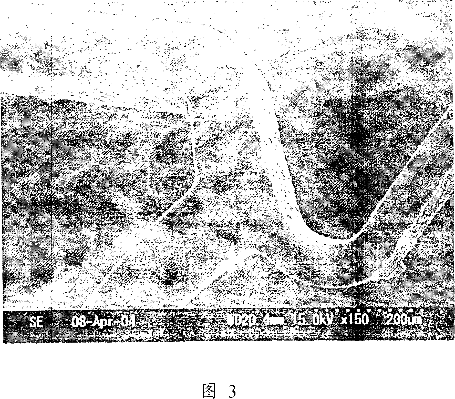 Organism indwelling support