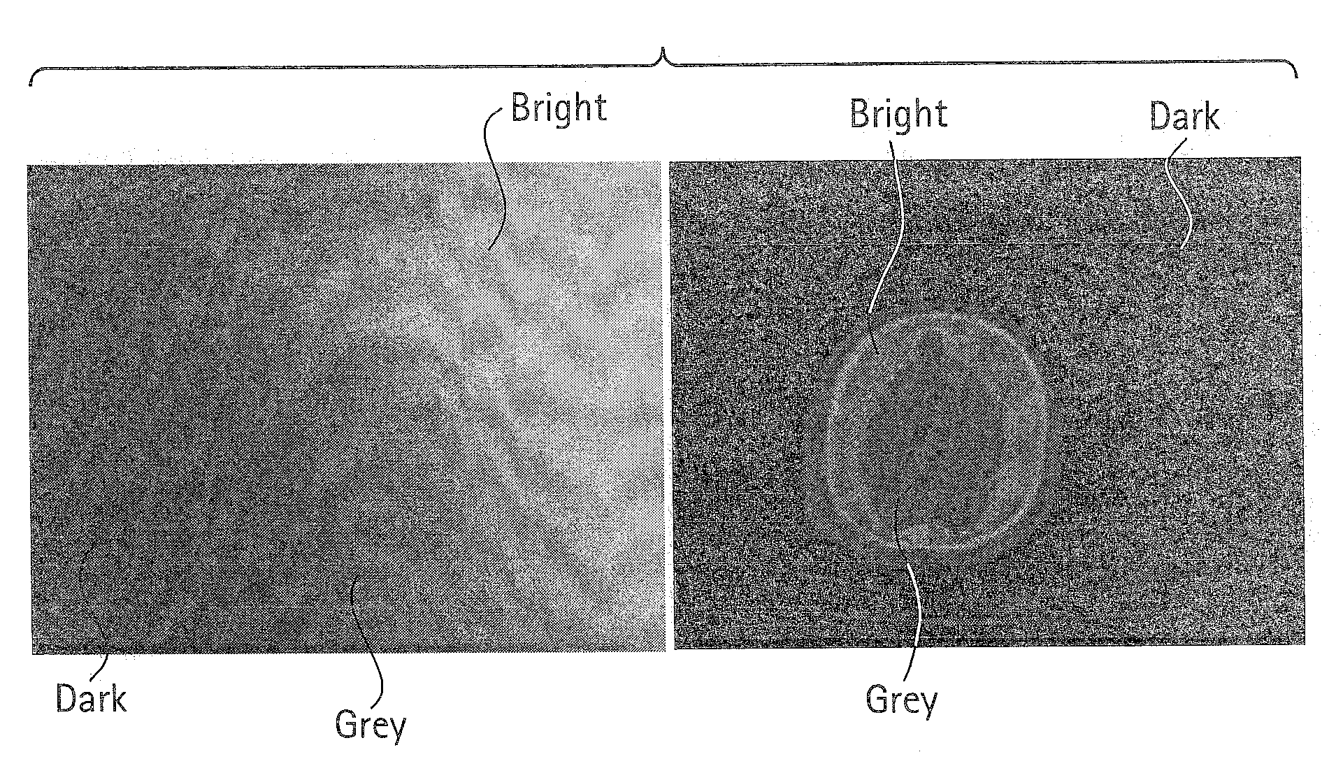 Machine learning based triple region segmentation framework using level set on pacs