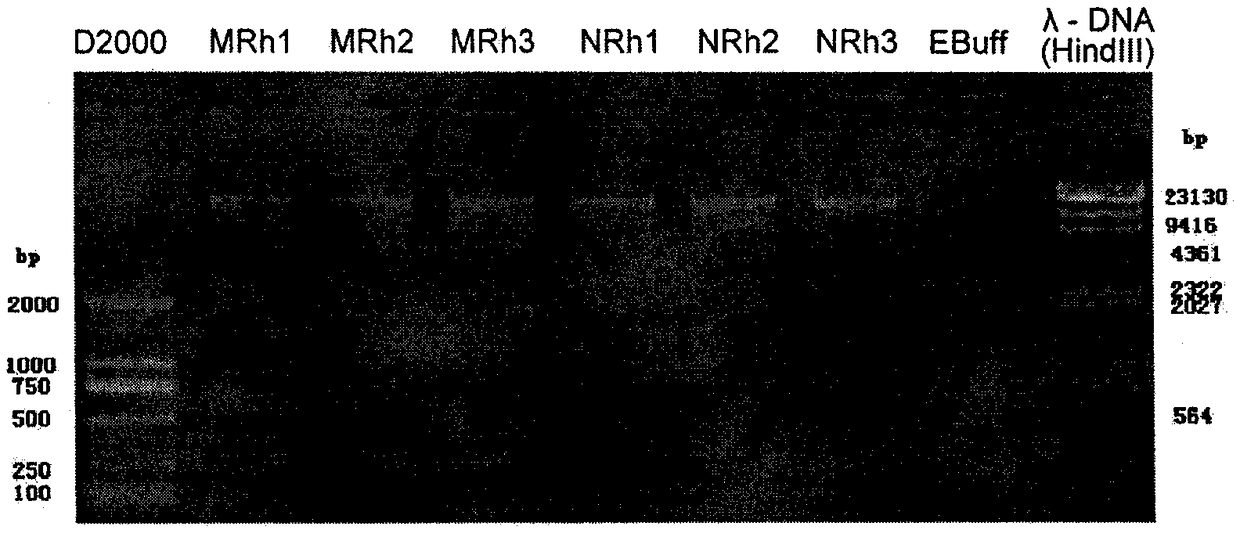 Method for detecting prokaryotic microorganisms in crop rhizosphere based on high-throughput sequencing