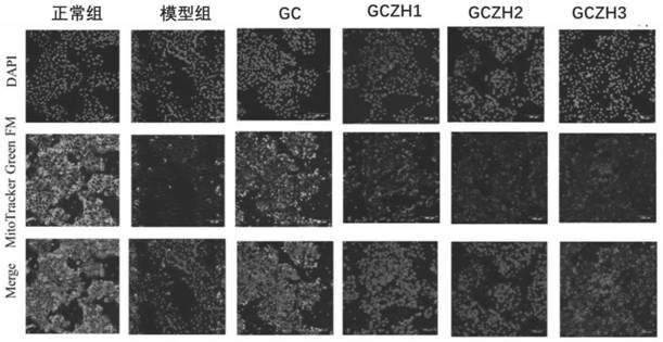 Application of 3'-geranyl citrus chalcone and composition in preparing products for treating fatty liver