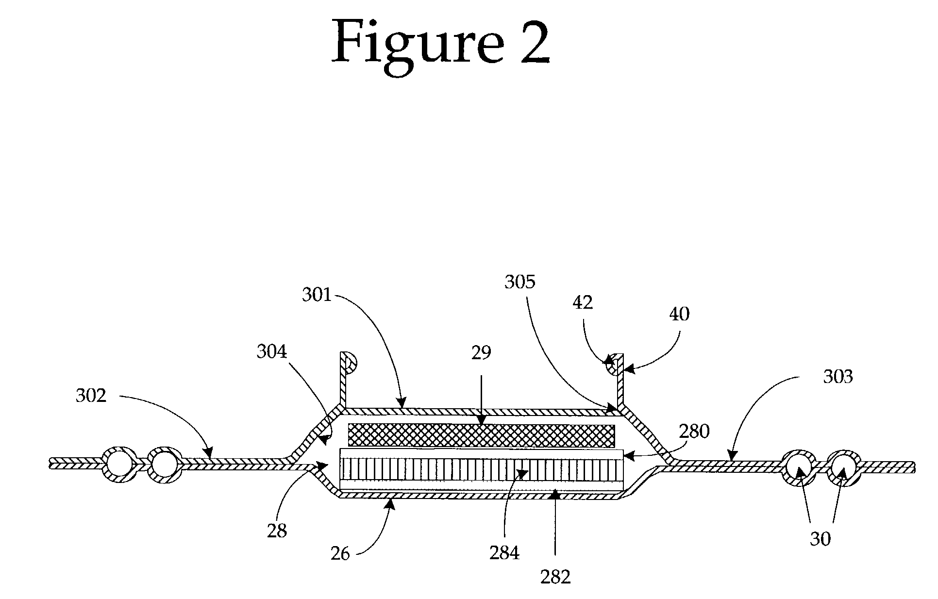 Absorbent articles containing absorbent cores having zoned absorbency and methods of making same