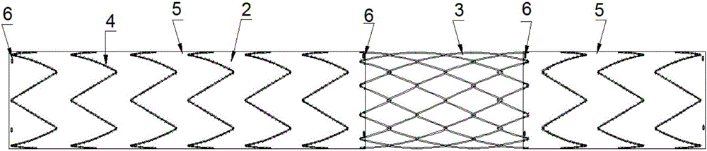 Aortic stent