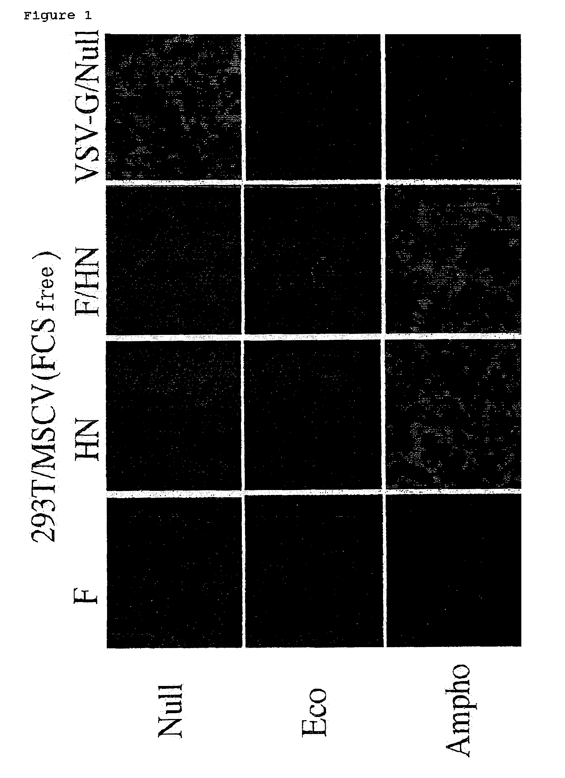 Pseudotype retroviral vectors containing membrane proteins having hemagglutinin activity