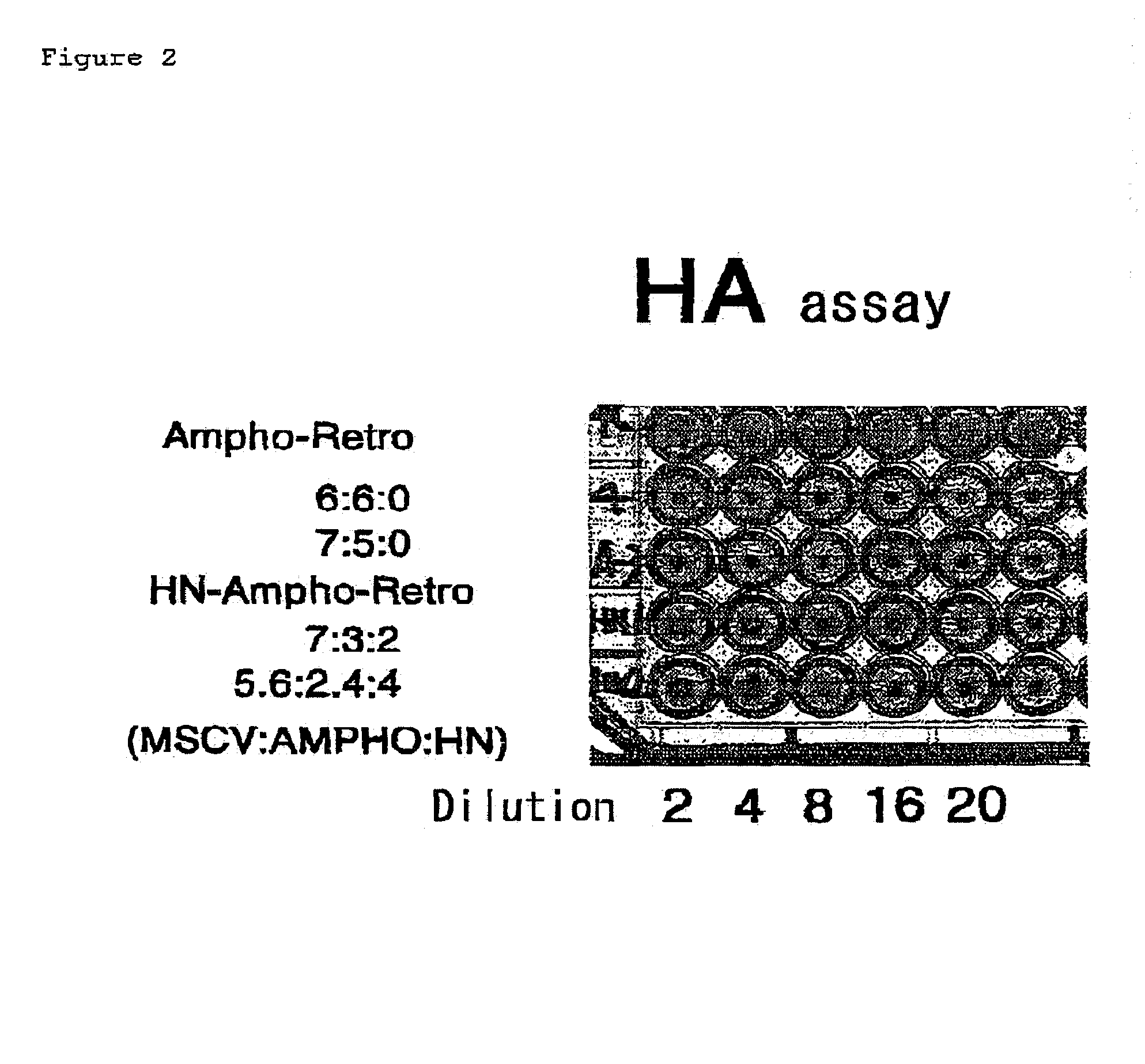 Pseudotype retroviral vectors containing membrane proteins having hemagglutinin activity