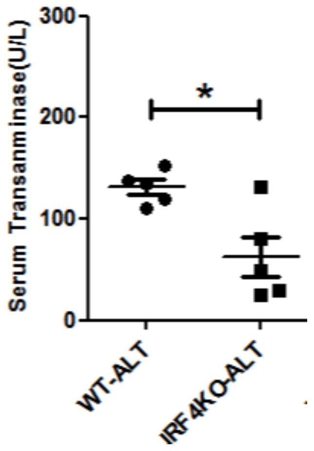 Application of irf4 gene in anti-schistosome infection