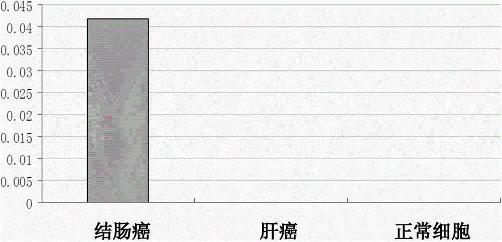 A tumor marker and its application in the preparation of colorectal cancer diagnostic reagents