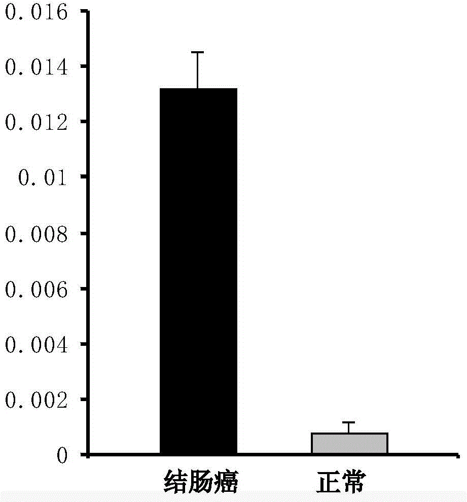 A tumor marker and its application in the preparation of colorectal cancer diagnostic reagents