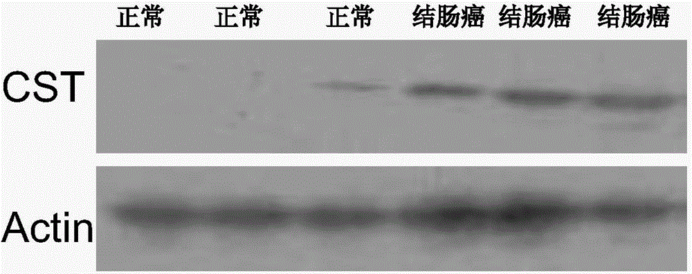 A tumor marker and its application in the preparation of colorectal cancer diagnostic reagents