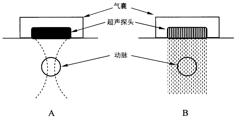 Noninvasive continuous blood pressure measurement device