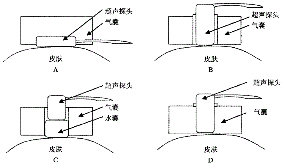 Noninvasive continuous blood pressure measurement device