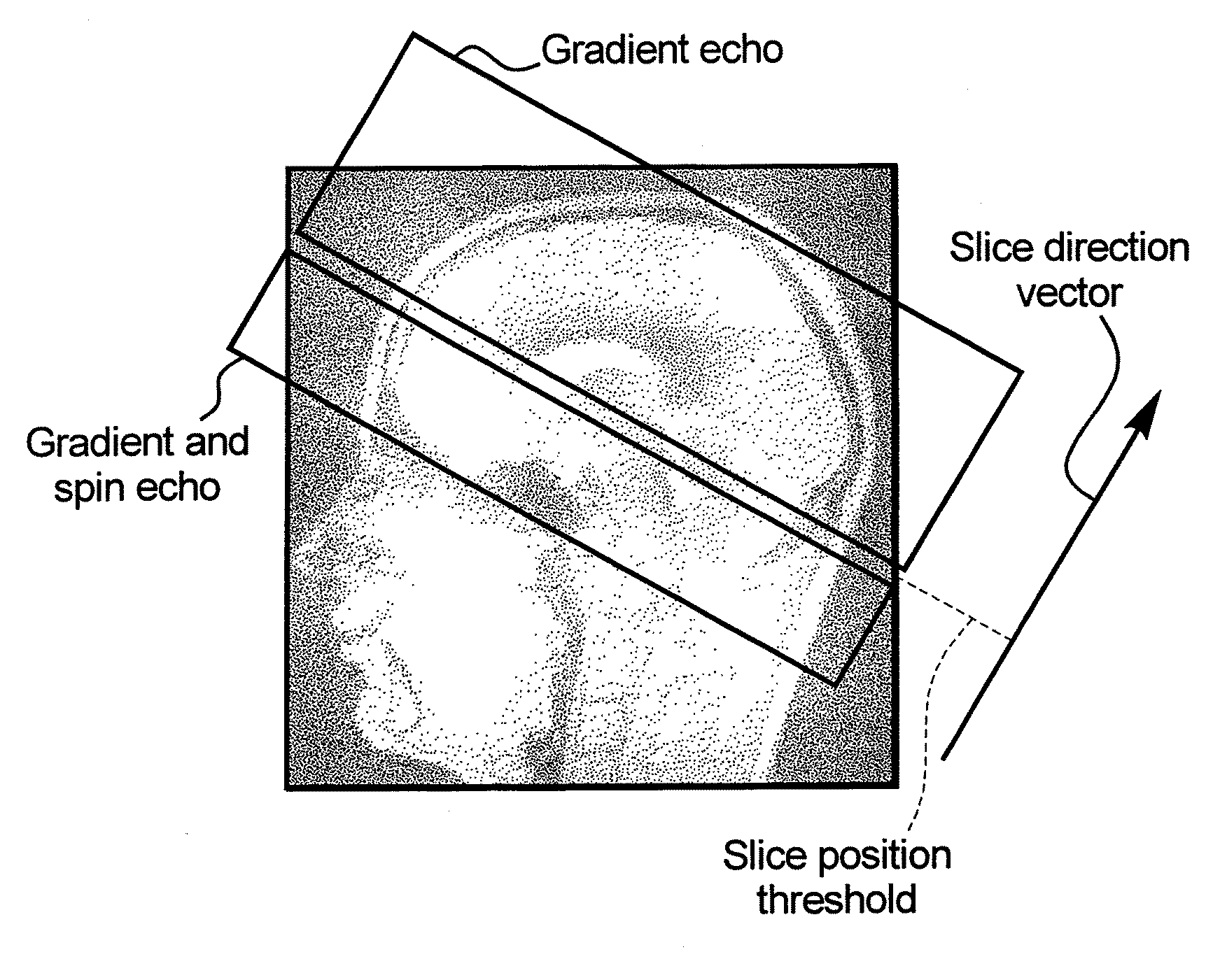 Magnetic resonance method and apparatus using dual echoes for data acquisition