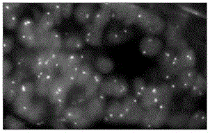 ERG gene detection probe, preparation method thereof and reagent kit