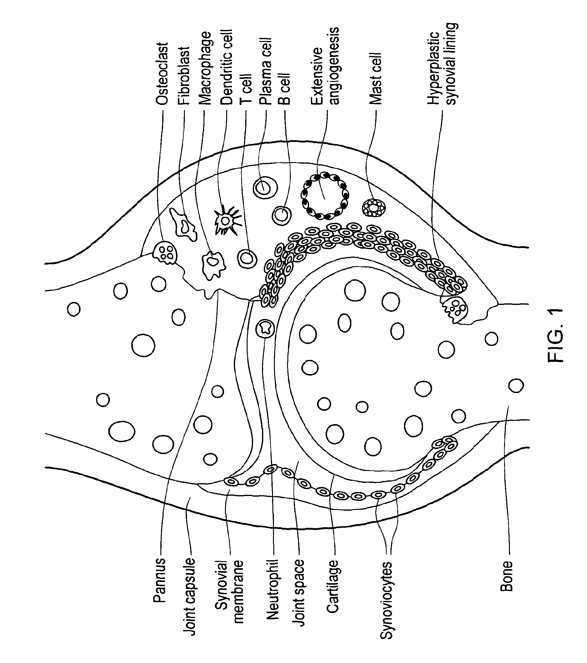 Antibody specifically binding synovial microvasculature of arthritis patients