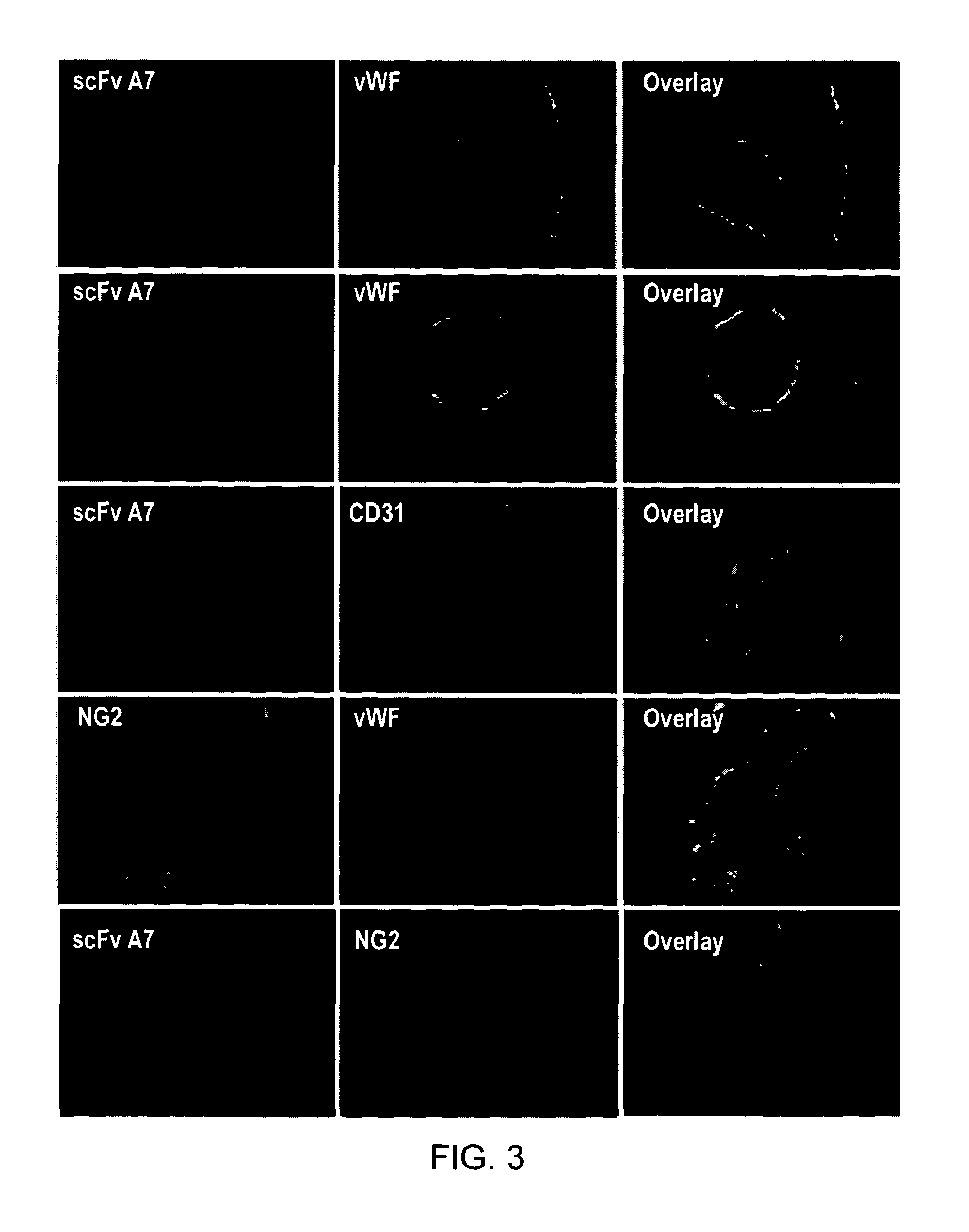 Antibody specifically binding synovial microvasculature of arthritis patients